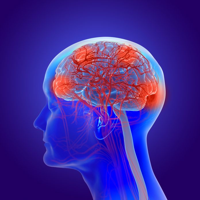 The drinks that could reduce strokes and dementia