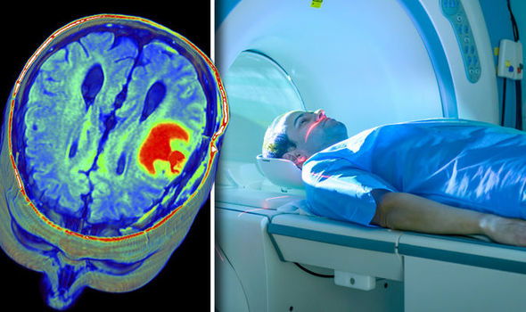 One In Five Cancer Patients In Spain Left Undiagnosed