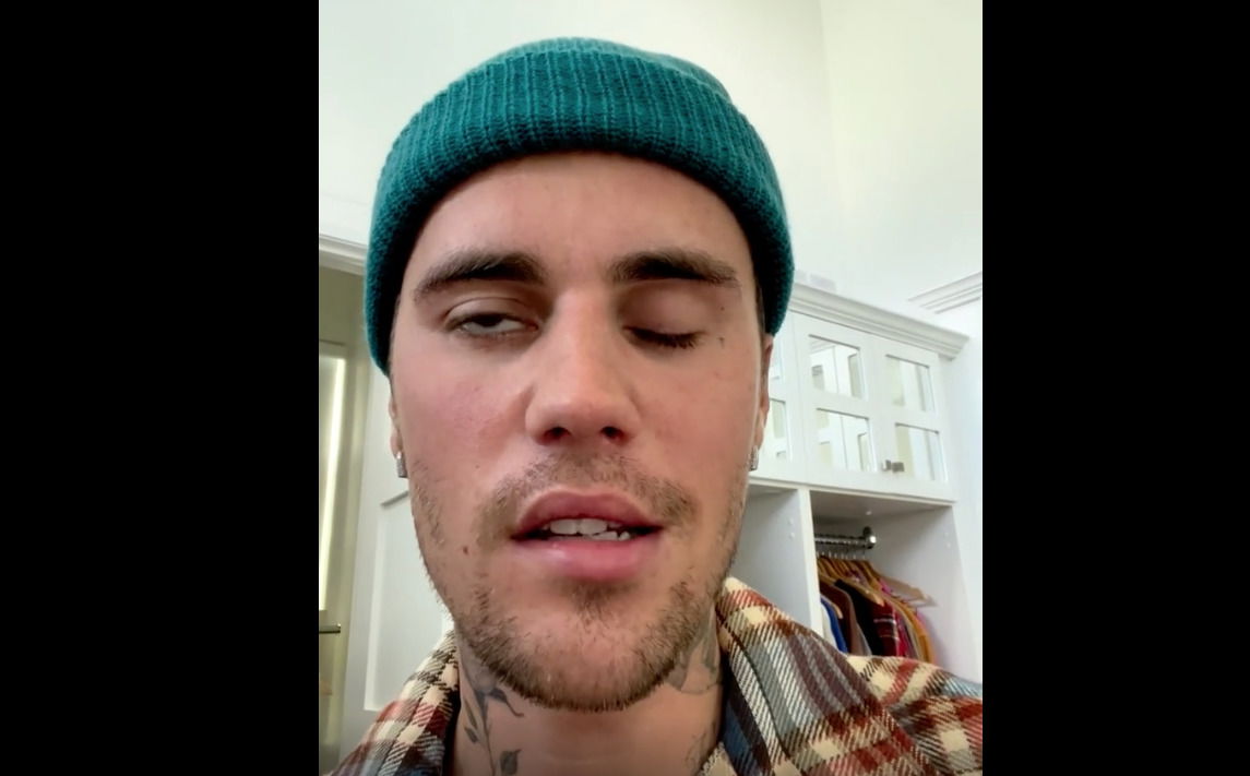 Justin Bieber Reveals Facial Paralysis Months After Wife Hailey ...