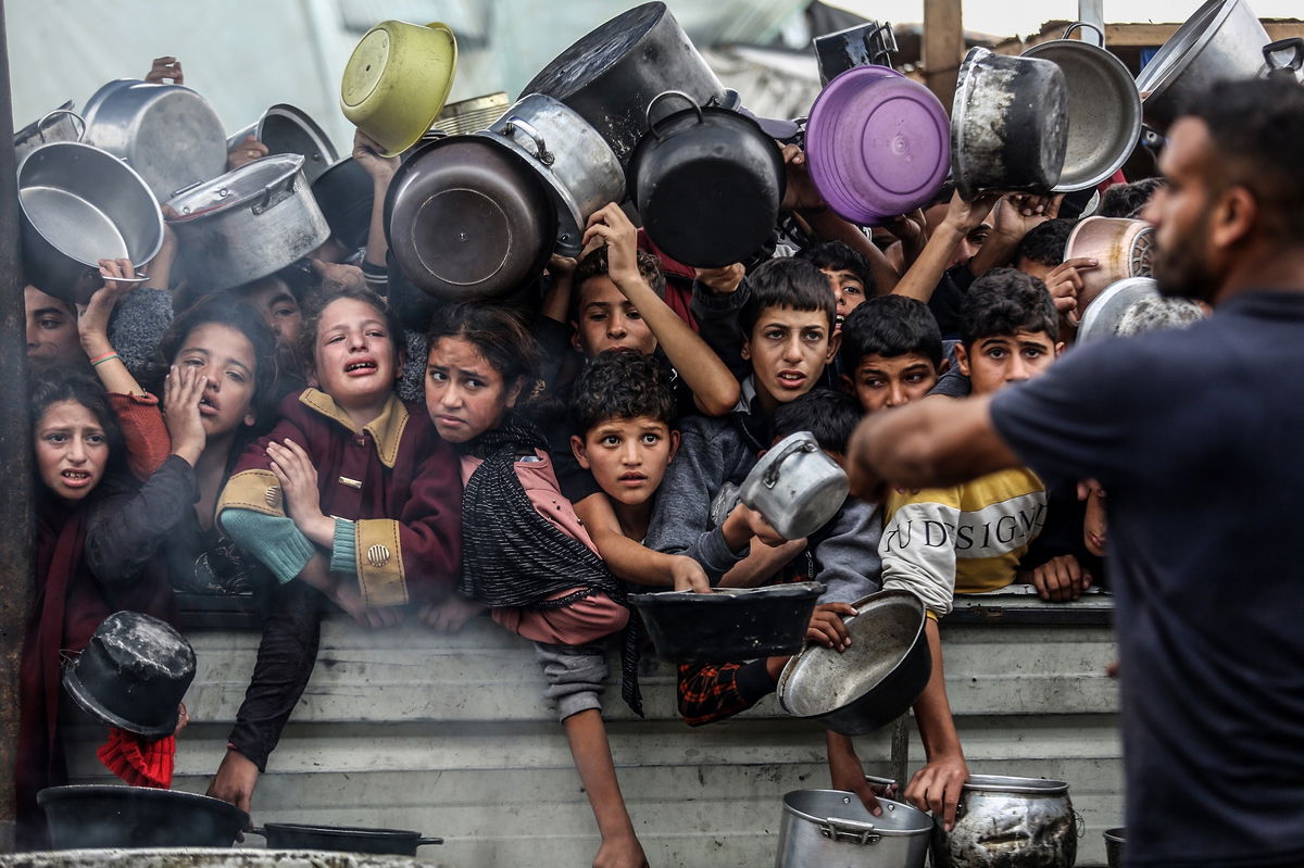 300 Gazan children could be sent to UK for NHS treatment\” />