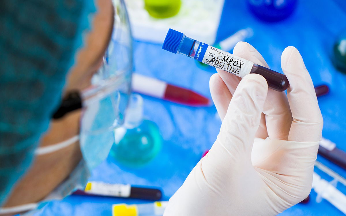 UK identifies new mpox variant in recent traveller